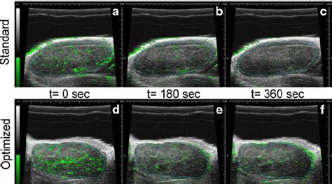 2d Ultrasound Images Of Representative Enlarged Lymph Nodes Immediately