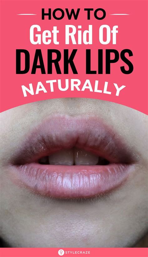 7 Home Remedies To Get Rid Of Black Lips Some People Develop