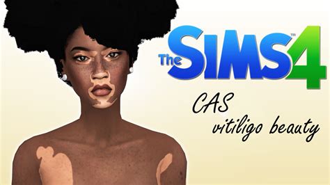 The Sims 4 Create A Sim Vitiligo Beauty Youtube