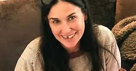 Demi Moore Talks About Losing Her Two Front Teeth Because Of Stress