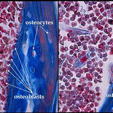 Bone Cells Osteoblasts Osteocytes And Osteoclasts Unpublished Image