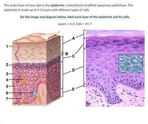 Solved The Outer Layer Of Your Skin Is The Epidermis A Keratinized