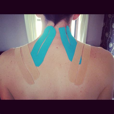How Beckham Tape Can Help You Beat Headaches More Than 10 Million Of Us