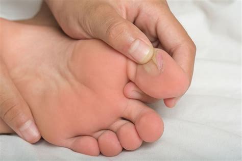 10 Common Foot Problems Facty Health