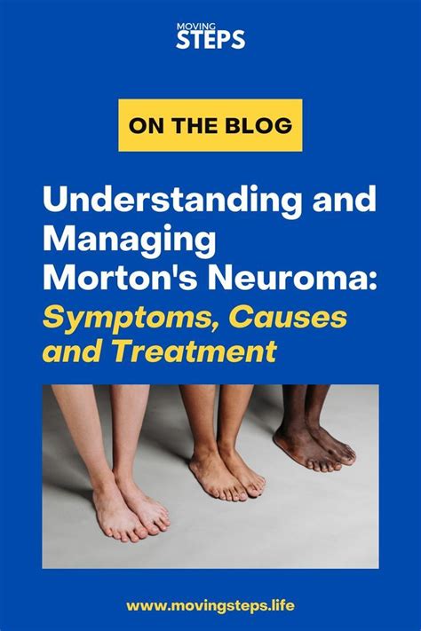 Understanding And Managing Morton S Neuroma Symptoms Causes And Treatment Artofit