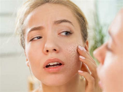 If You Have Dry Skin You Must Avoid These Things At All Costs