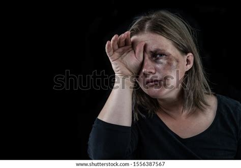 Crying Woman Victim Domestic Violence Abuse Stock Photo 1556387567