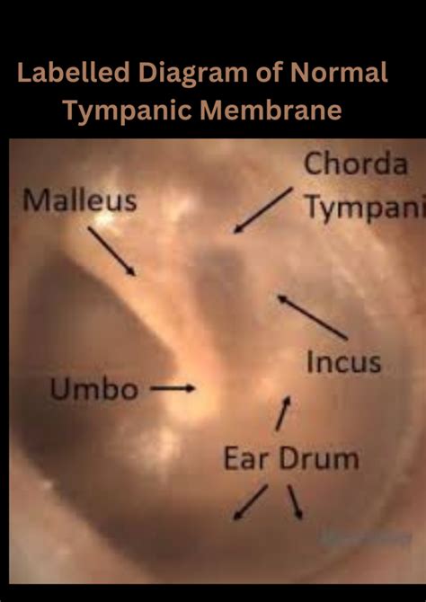 Diving Into The Eardrum Normal Bulging And Retracted Tympanic