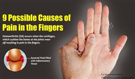 9 Possible Causes Of Pain In The Fingers And Its Treatment