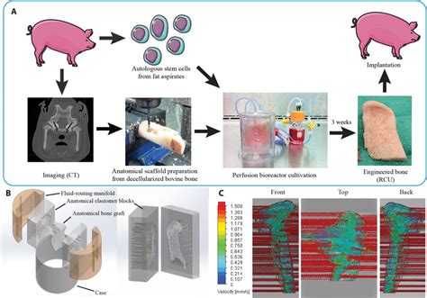 Tissue Engineered Autologous Grafts For Facial Bone Reconstruction