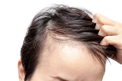 Thinning Hair Signs The Essential Guide To The Signs Of Hair Loss
