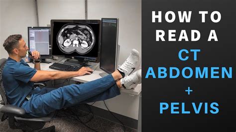 Radiology How To Read A Ct Abdomen And Pelvis My Search Pattern Youtube