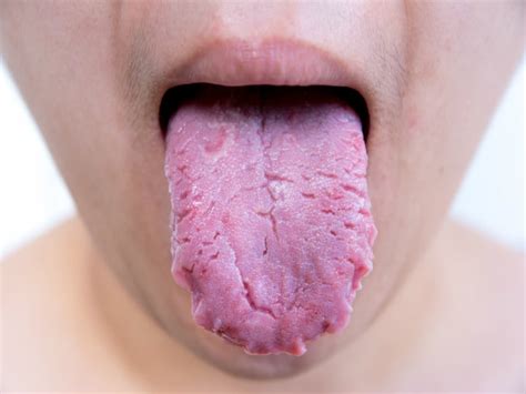 Maybe you would like to learn more about one of these? Harmful Things That Happen When You Do Not Brush Your ...