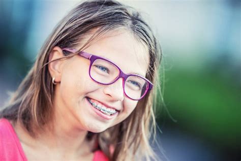 Young Caucasian Teen Girl Portrait With Dental Teeth Braces Stock Photo 59c