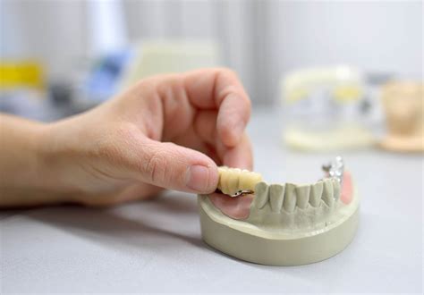 Dental Repair Can Work For All Implants