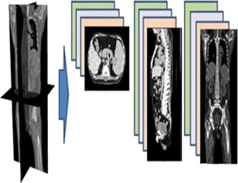 Deep Learning Techniques For Medical Image Segmentation Achievements And Challenges Journal