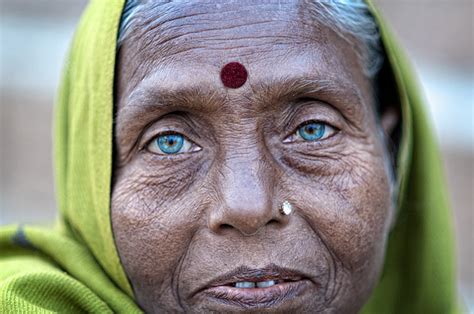 Deformutilation Blue Eyes In India