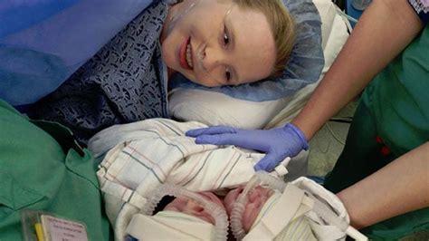 Rare Conjoined Twins Born At Atlanta Hospital Cbs46 News