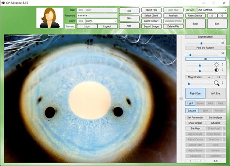 Mp Digital Iriscope Iridology Camera Eye Testing Machine Ce Dhl