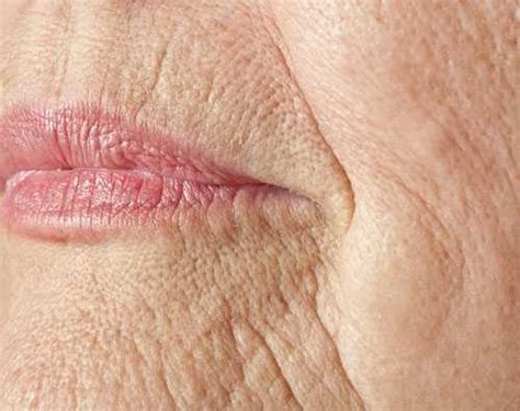 Dry Skin A Dermatology Problem That Is More Than Skin Deep Kansas
