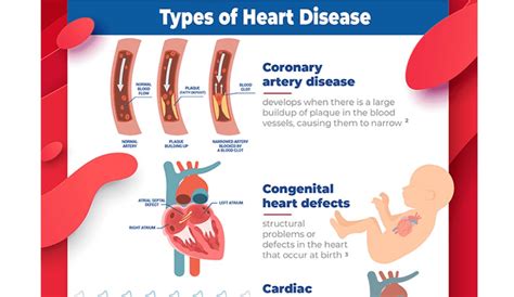 Infographic Types And Causes Of Heart Disease Boomers Daily