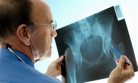 Total Hip Replacement Surgery The Process Proliance Orthopedic