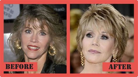 Jane Fonda Plastic Surgery Before And After Jane Fonda ...