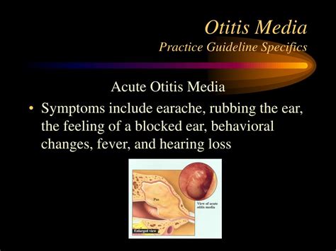 PPT Otitis Media Practice Guidelines PowerPoint Presentation Free