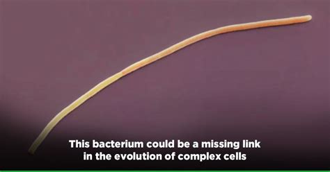 World S Biggest Bacteria Ever Discovered Is A Centimetre Long String