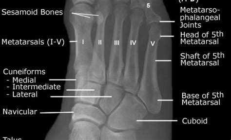 Normal foot and ankle x ray anatomy Radiographic Anatomy - Foot Oblique. Very interesting to ...
