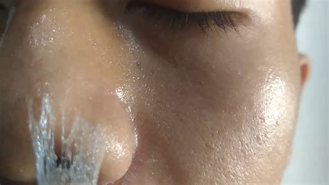 Nose Skin Peeling Continuously Youtube