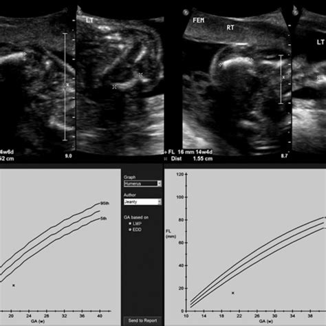 Morphology Scan