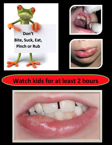 Lip Biting After Treatment Texas Pediatric Dentistry