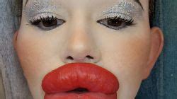 Woman With World S Biggest Lips Is Now Splashing Out On Her