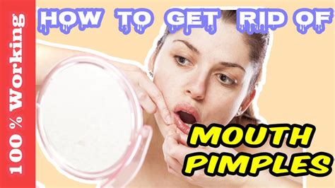 How To Get Rid Of Pimples Around Mouth Overnight Fast Home Remedies