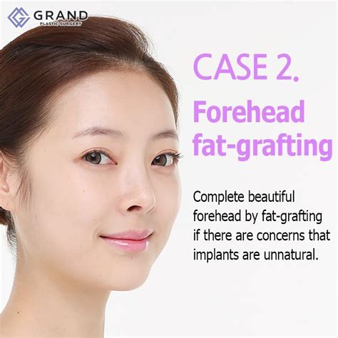 Complete your forehead more beautiful with Grand.🎀 For free ...
