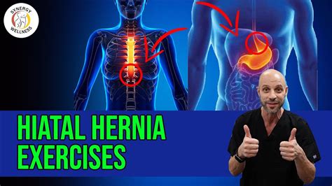 Hiatal Hernia Exercises Youtube