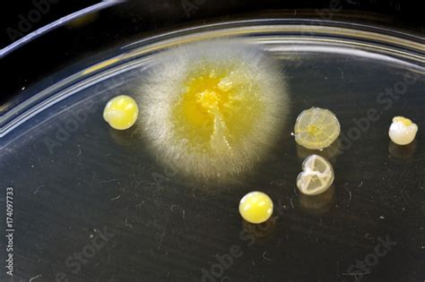 Different Shaped Colonies Of Bacteria Yeast And Mold Growing On Agar