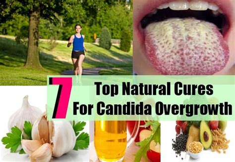 Top Effective Natural Remedies And Cures For Candida Overgrowth