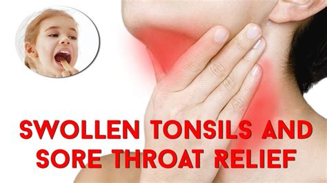 Cure Swollen Tonsils And Sore Throat Relief In Only 10 Hours