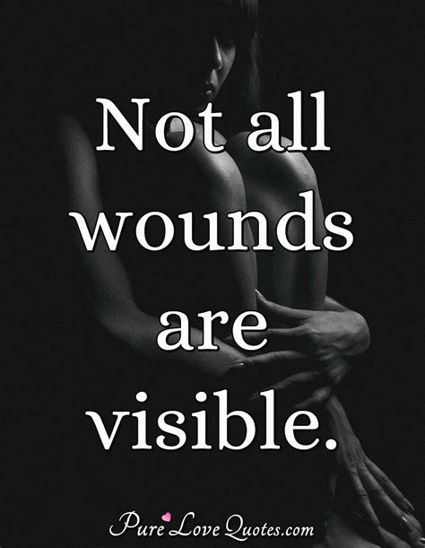 Not All Wounds Are Visible Purelovequotes