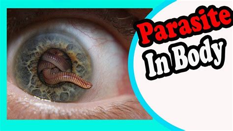 10 Signs And Symptoms Your Body Is Full Of Parasites Youtube