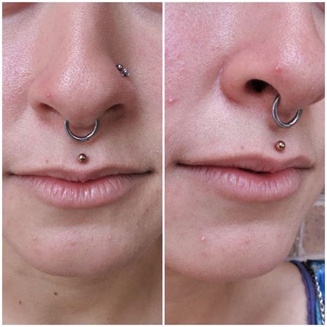 Philtrum Piercing With Rosey Gold Titanium Jewelry By Neometal
