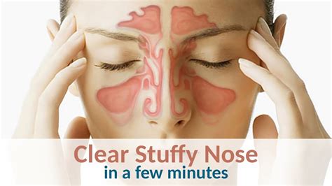 6 Tips To Clear A Stuffy Nose In Minutes YouTube