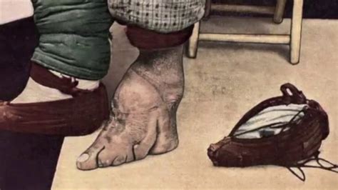 Ancient Foot Binding In China Was A Symbol Of Beauty And Elegance The
