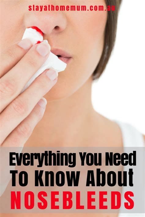 Everything You Need To Know About Nosebleeds Stay At Home Mum