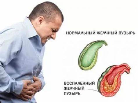 Если болит желчный диета