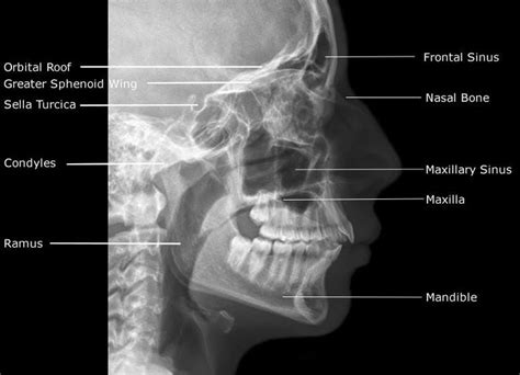 They maintain connections to other osteocytes. Radiographic Anatomy of Facial Bones and Mandible with Radiological Abnormalities of the Skull ...