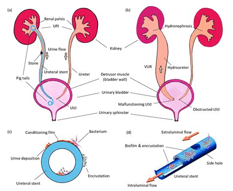 Illustration Of The Urinary Tract Under Various Physiological And