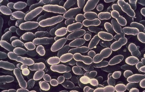 Anthrax Bacillus Colonies After 6 Hours Stock Image B2200006